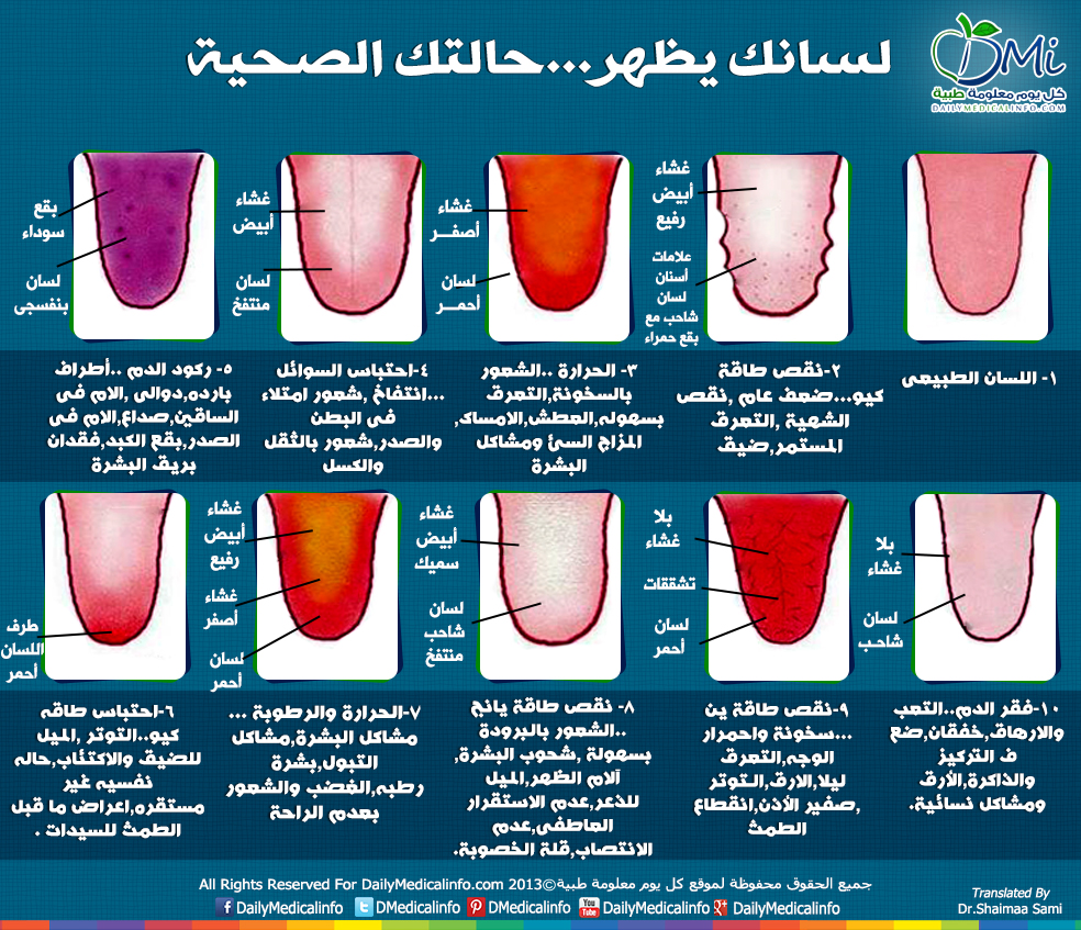 DailyMedicalinfo_tongue_conditions.jpg